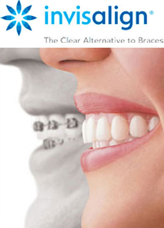 invisalign huntington beach