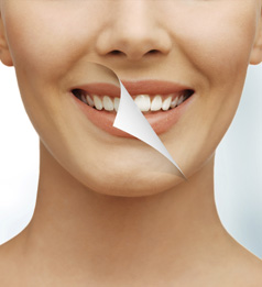 teeth whitening huntington beach